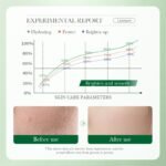 BIOAOUA Centella Asiatica Soothing Repairing Six-Piece Set (New) 30ml+100g+120ml+80ml+20g+50g - Image 7