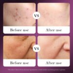 SADOER Snail Recombinant Collagen Toner 120ml - Image 3