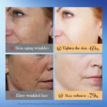 SADOER Type 3 Collagen Firming and Wrinkle-Smoothing Mask 30ml - Image 2